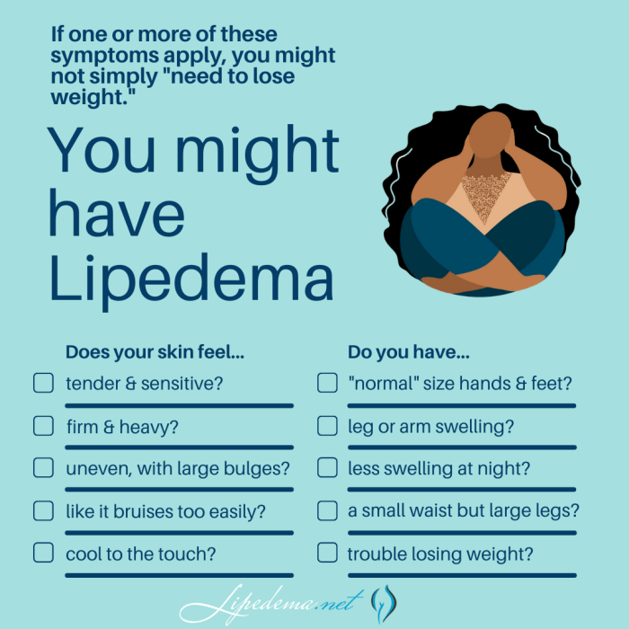 Lipedema diagnosis steps